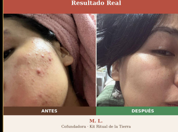 Testimonio